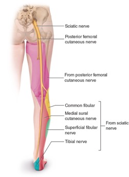 Sciatic Pain | Physionorth