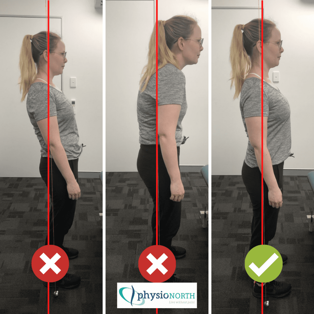 How Is Your Posture Physionorth